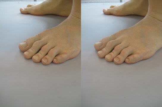 Boy, Ron Mueck at ARoS