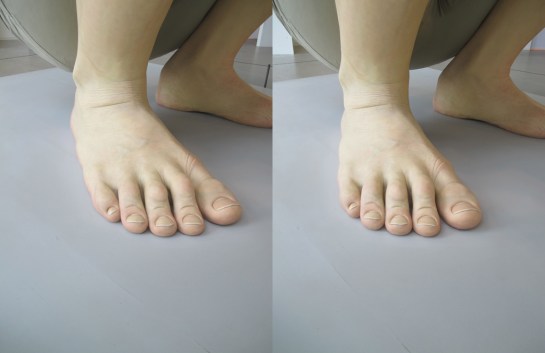 Boy, Ron Mueck at ARoS